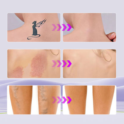 🎁Last Day – Free Body Brush!💜All-in-one moisturizer, concealer & coverage Perfector